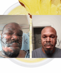 Alternative view of Scar Cream (Customers Say it's the Best Dang Scar Cream Period)